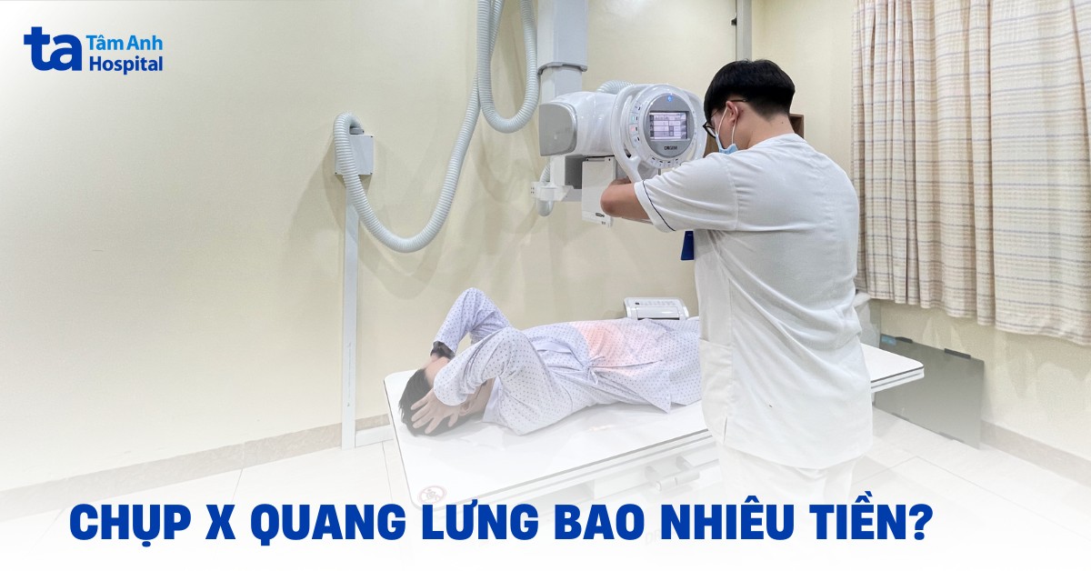 Chụp X quang lưng bao nhiêu tiền? Yếu tố ảnh hưởng đến giá