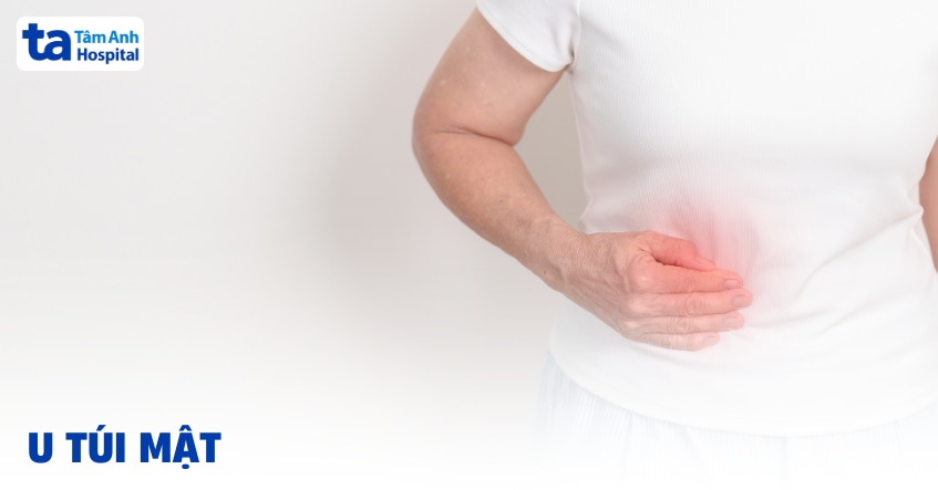 Chẩn đoán u túi mật ác tính và lành tính