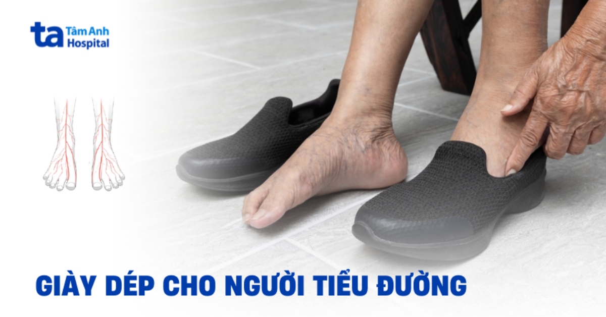 Giày dép cho người tiểu đường nên lựa chọn như thế nào?