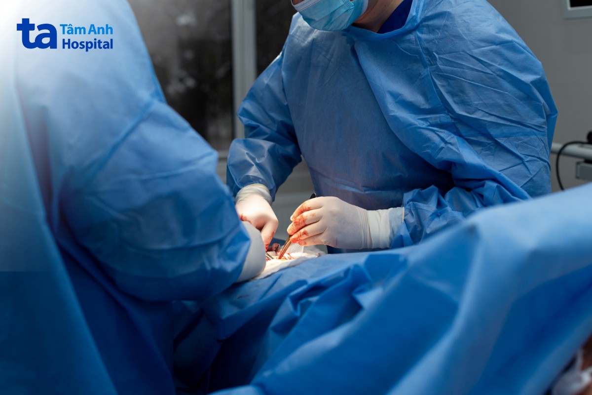 điều trị huyết khối tĩnh mạch mạc treo tràng trên