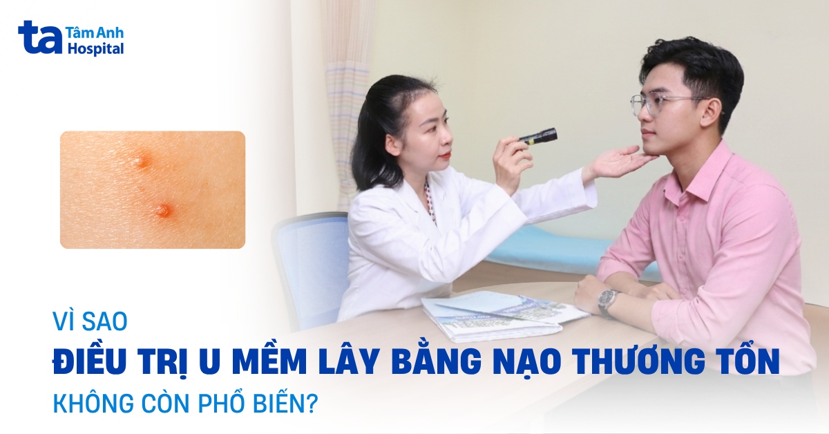 Vì sao điều trị u mềm lây bằng nạo thương tổn không còn phổ biến?