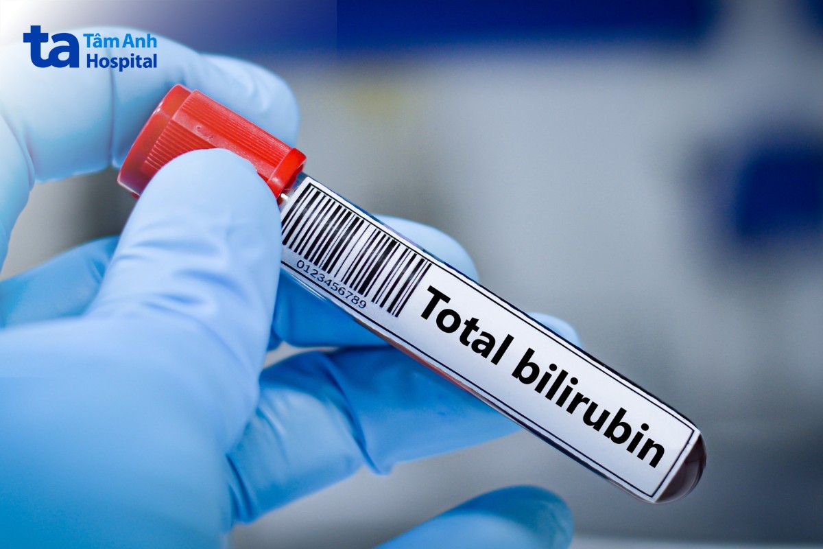 định lượng bilirubin toàn phần