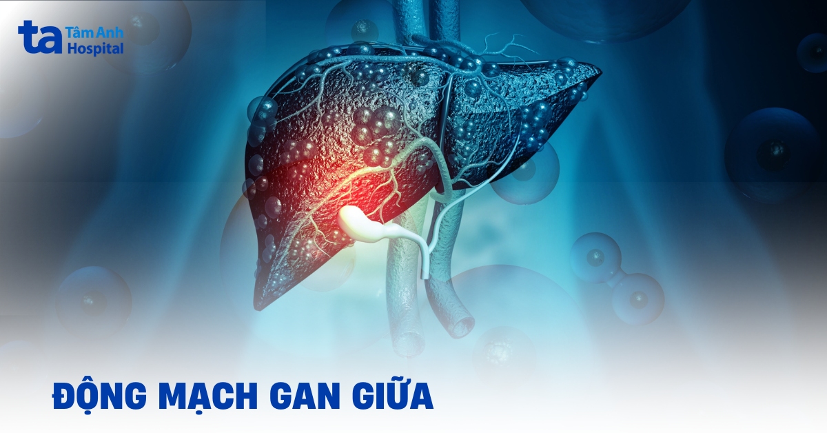 Các biến thể về nguồn gốc của động mạch gan giữa