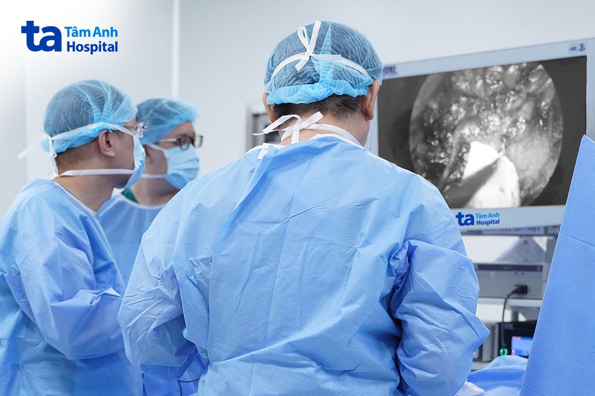 e kíp bác sĩ phẫu thuật nội soi lấy sỏi