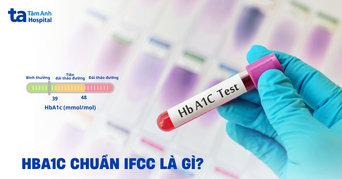 Xét nghiệm HbA1c IFCC là gì? Khi nào được chỉ định thực hiện?