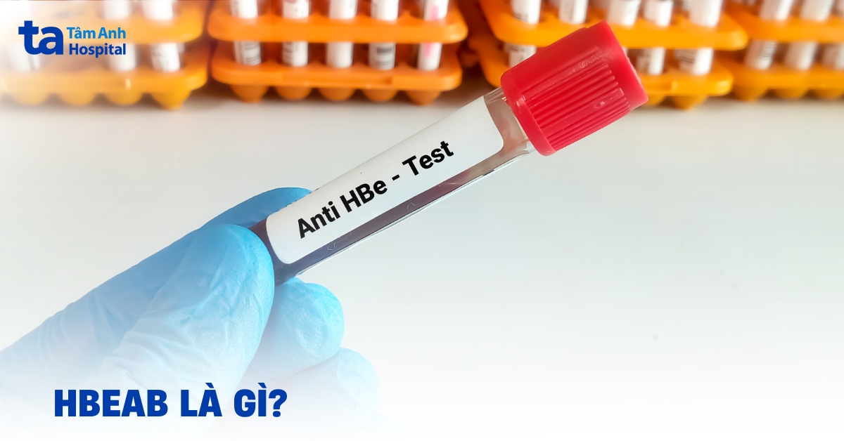 HBeAb là gì? Vai trò và ý nghĩa trong chẩn đoán