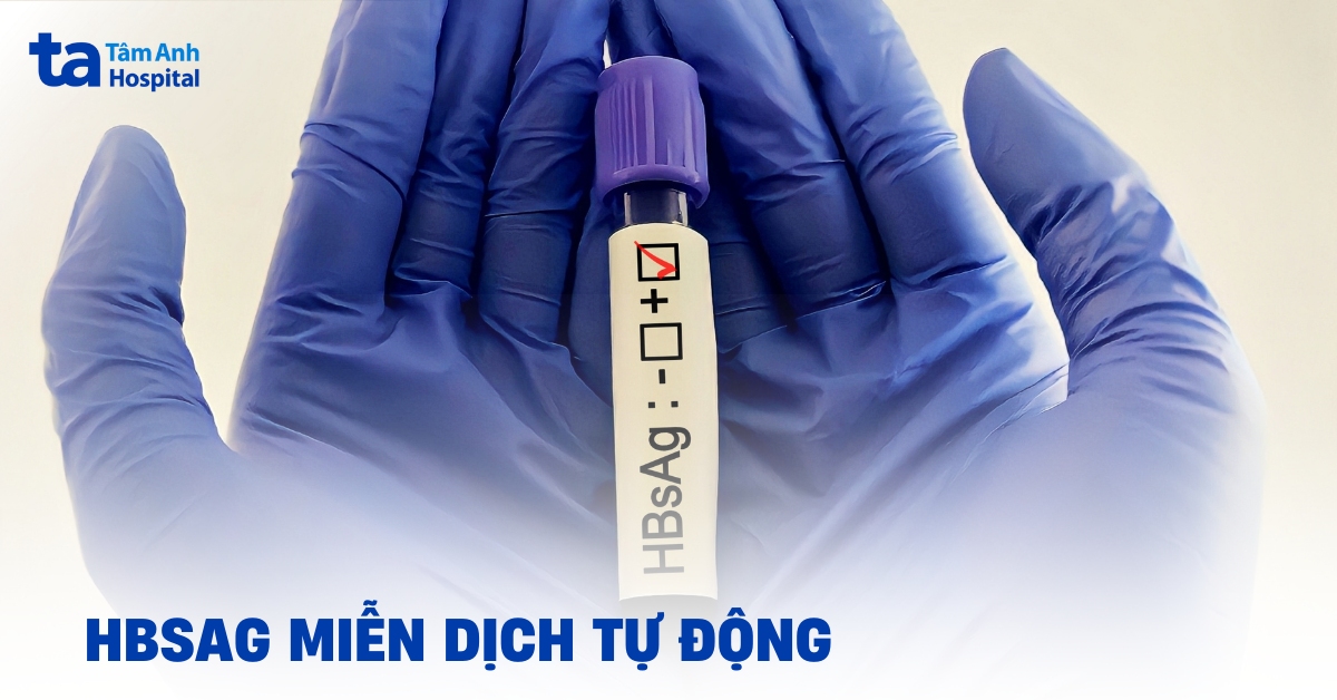 Xét nghiệm HBsAg miễn dịch tự động hoạt động như thế nào?