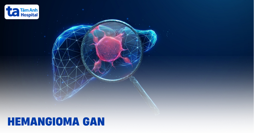 Hemangioma gan là gì? Có nguy hiểm không?