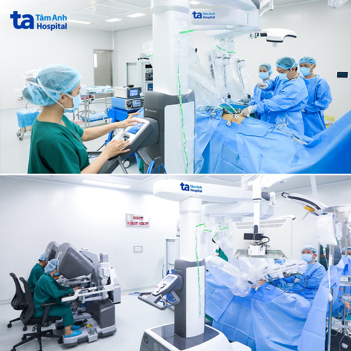 hình trên và hình dưới buổi phẫu thuật