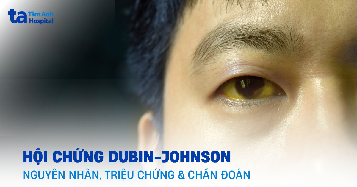 Hội chứng Dubin-Johnson: Nguyên nhân, triệu chứng và chẩn đoán