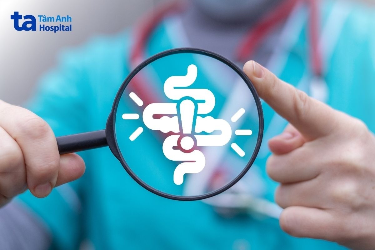 hội chứng ruột kích thích