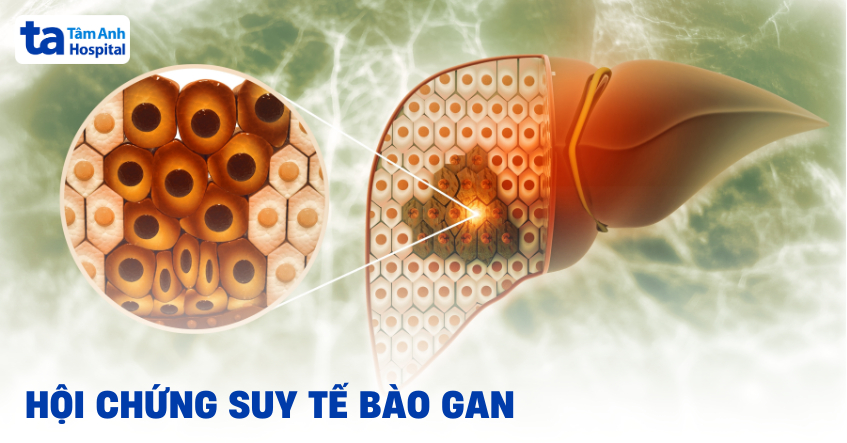 Hội chứng suy tế bào gan: Nhận biết sớm và xử lý đúng cách
