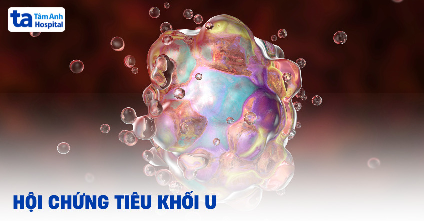 Hội chứng tiêu khối u: Nguyên nhân, biểu hiện, triển vọng điều trị
