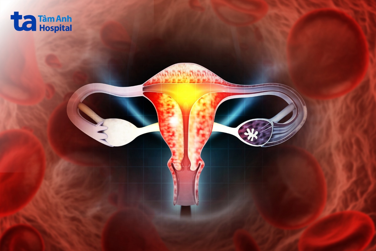 HPV type 52 có thể gây tổn thương cổ tử cung