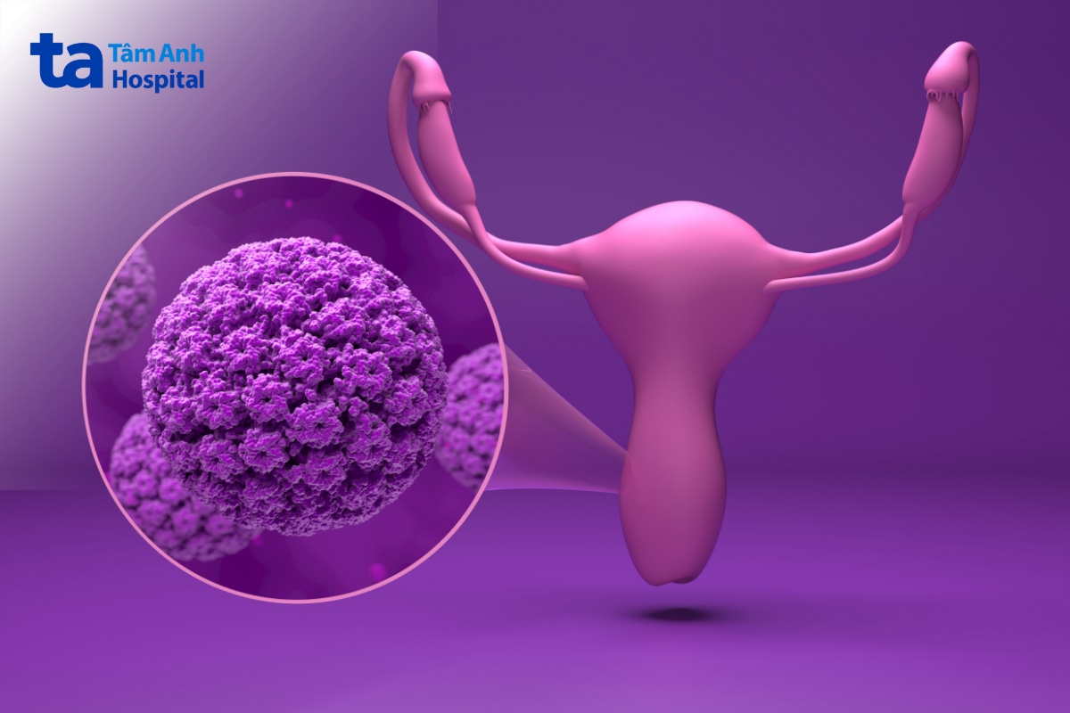 HPV type 56 liên quan tổn thương cổ tử cung