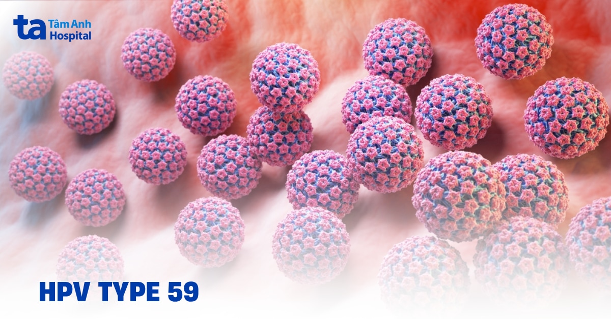 HPV type 59 và các đặc điểm dễ bỏ sót