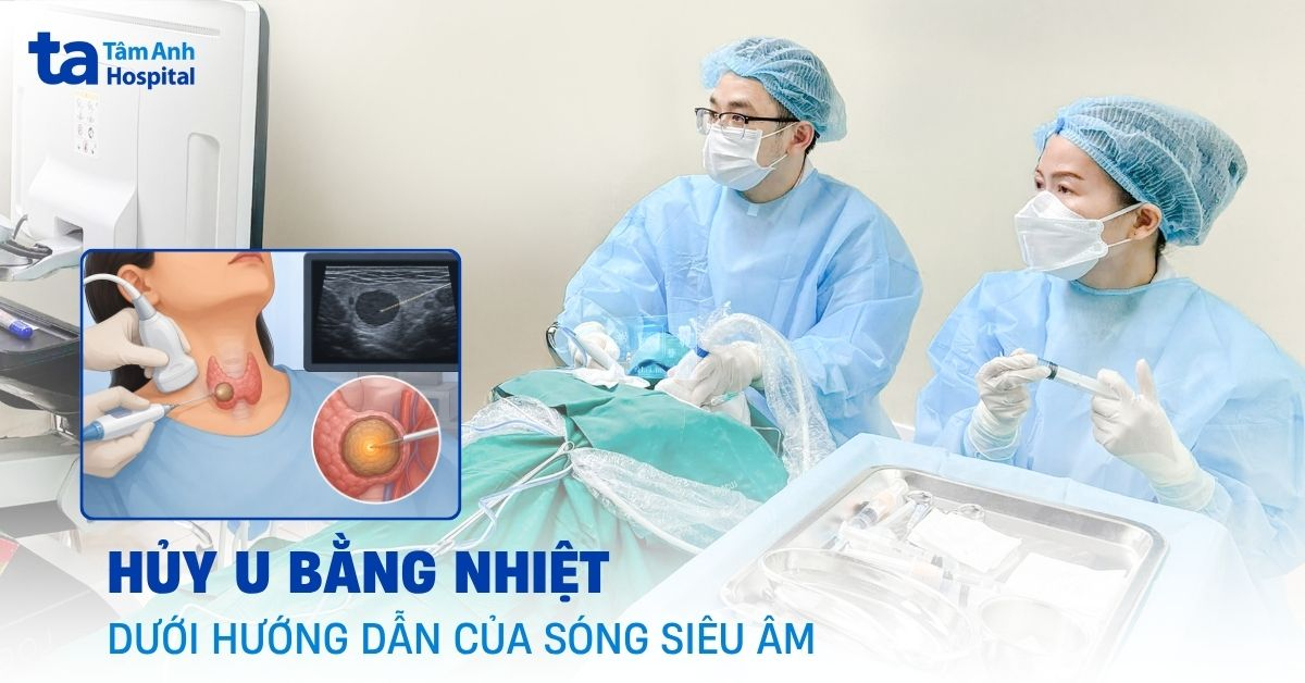 Hủy u bằng nhiệt dưới hướng dẫn của sóng siêu âm
