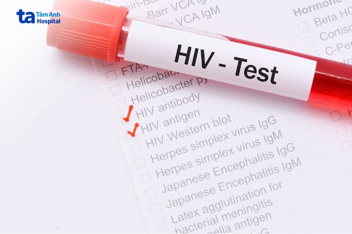 khám sức khỏe tổng quát có xét nghiệm hiv không