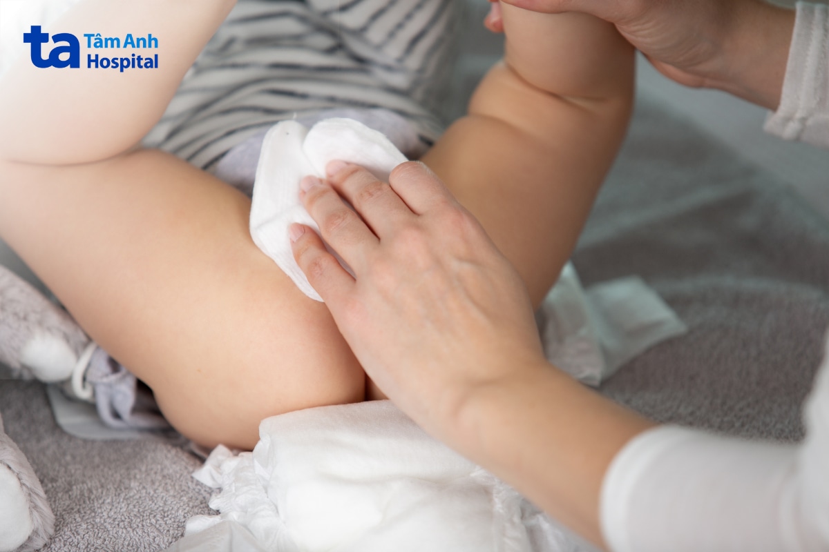 Theo dõi tính chất phân giúp nhận biết tiêu chảy ở trẻ 2 tháng tuổi.