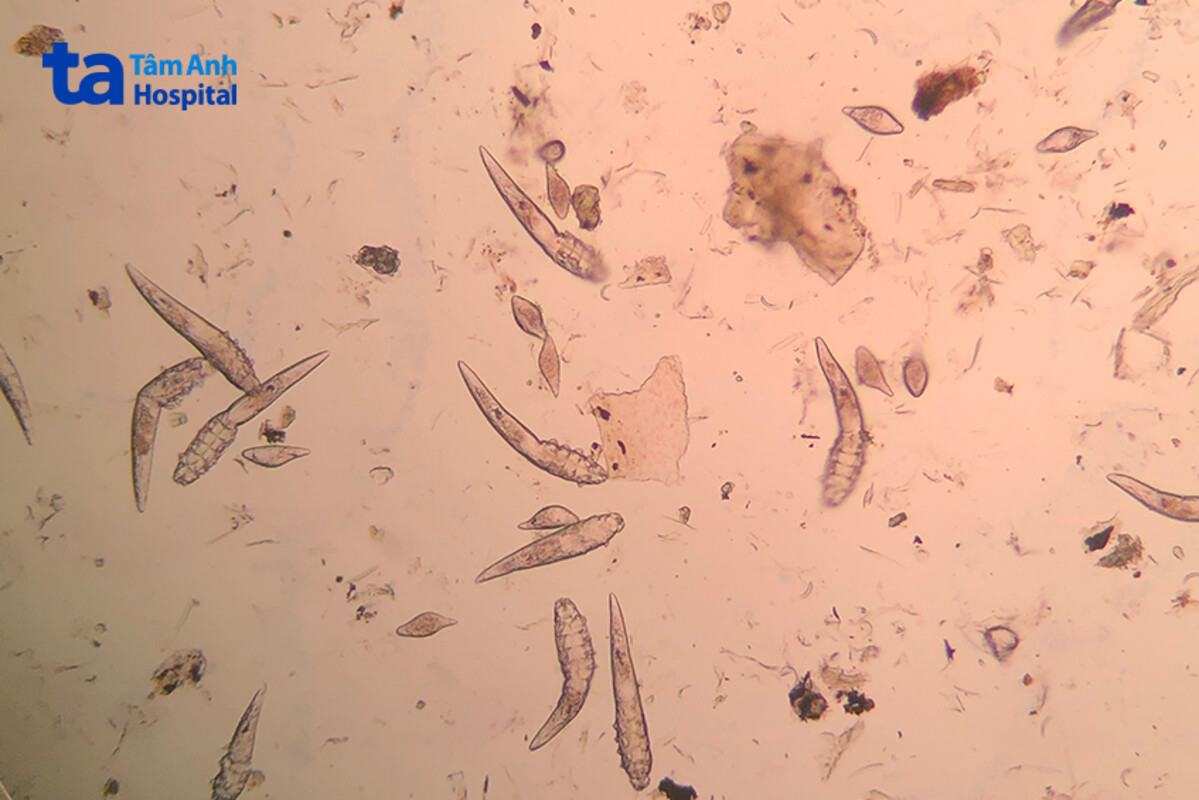 ký sinh trùng demodex ở chó không có khả năng lây sang người