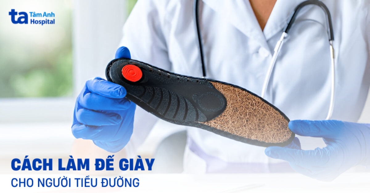 Hướng dẫn làm đế giày cho người tiểu đường bị biến chứng bàn chân