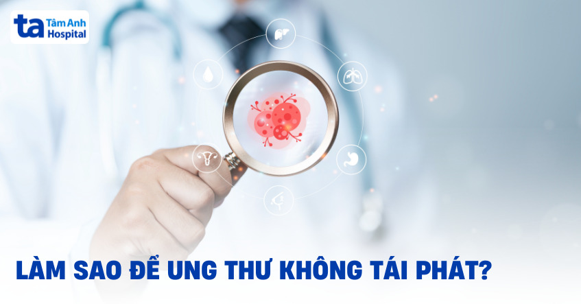 Làm sao để ung thư không tái phát? Các lưu ý giúp giảm nguy cơ