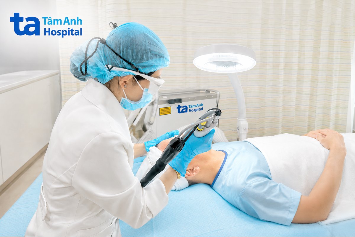 laser 6d được dùng điều trị sẹo mụn
