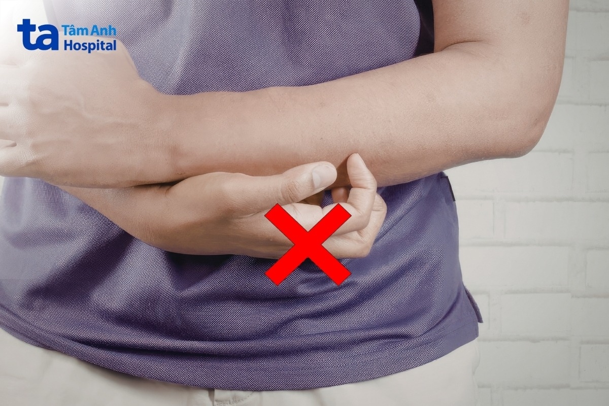 lưu ý trước và sau khi điều trị