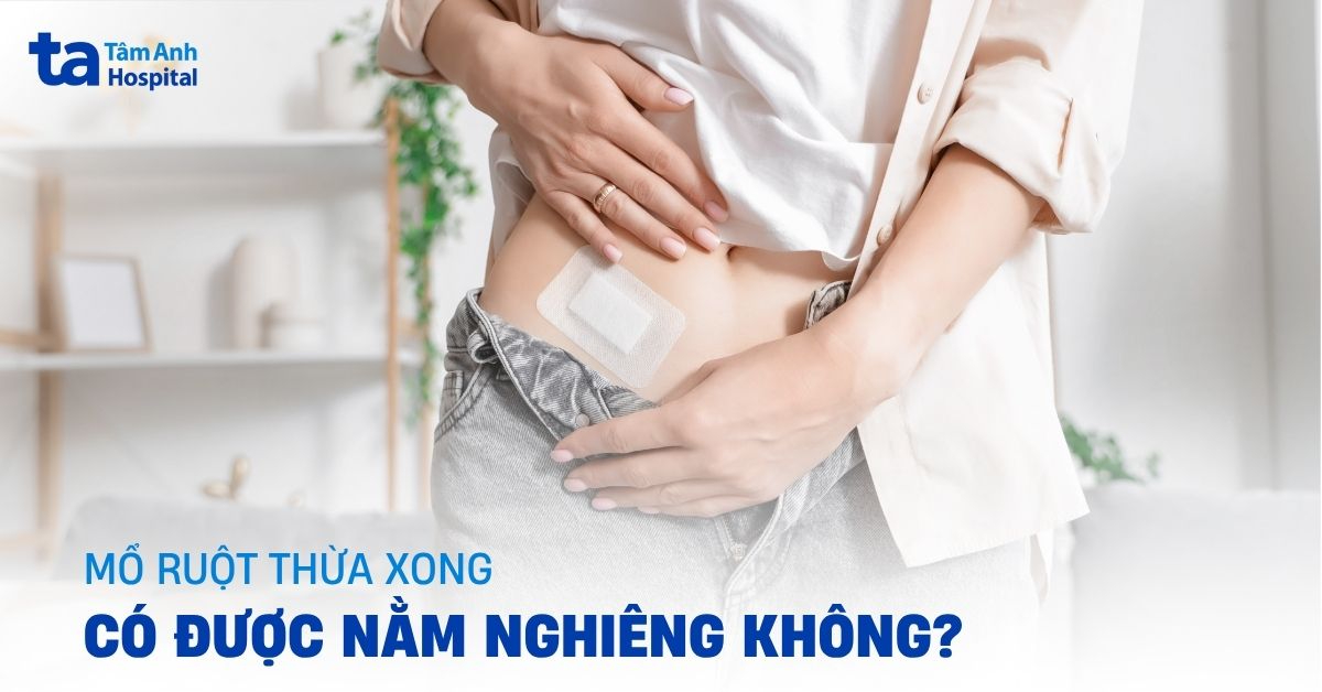 Mổ ruột thừa xong có được nằm nghiêng không?