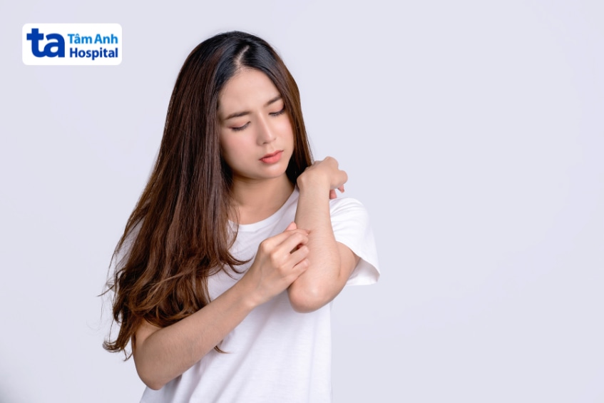 Người có tiền sử dị ứng các loại bí nên thận trọng khi ăn bí đỏ.