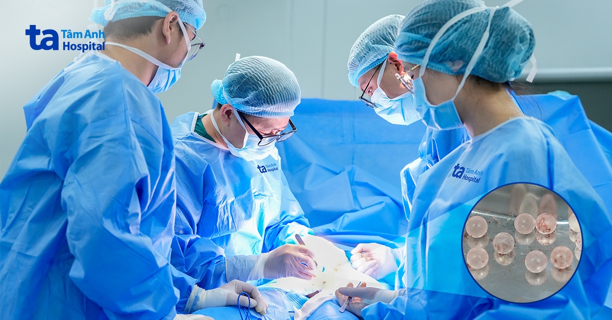 Người đàn ông tự “độ bi” bằng 20 viên thủy tinh