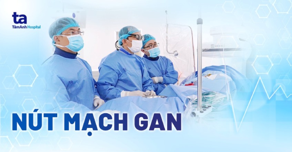 nút mạch gan