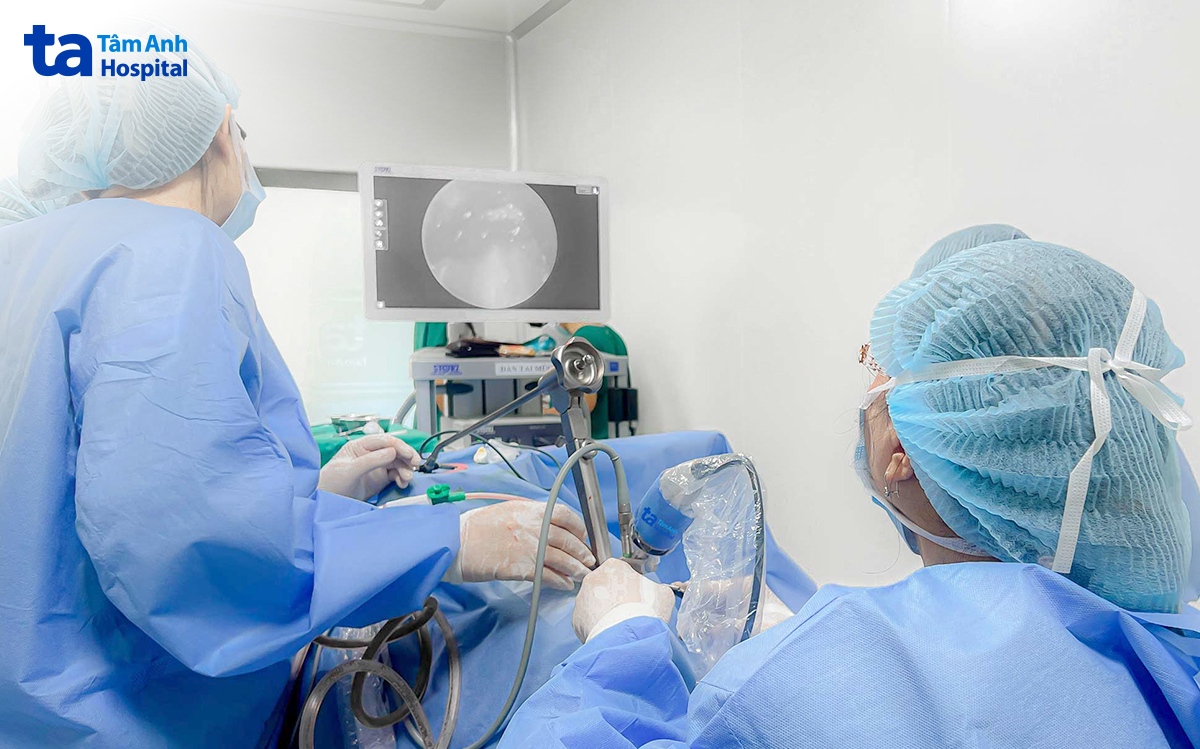 phẫu thuật nội soi laser cắt u thanh quản