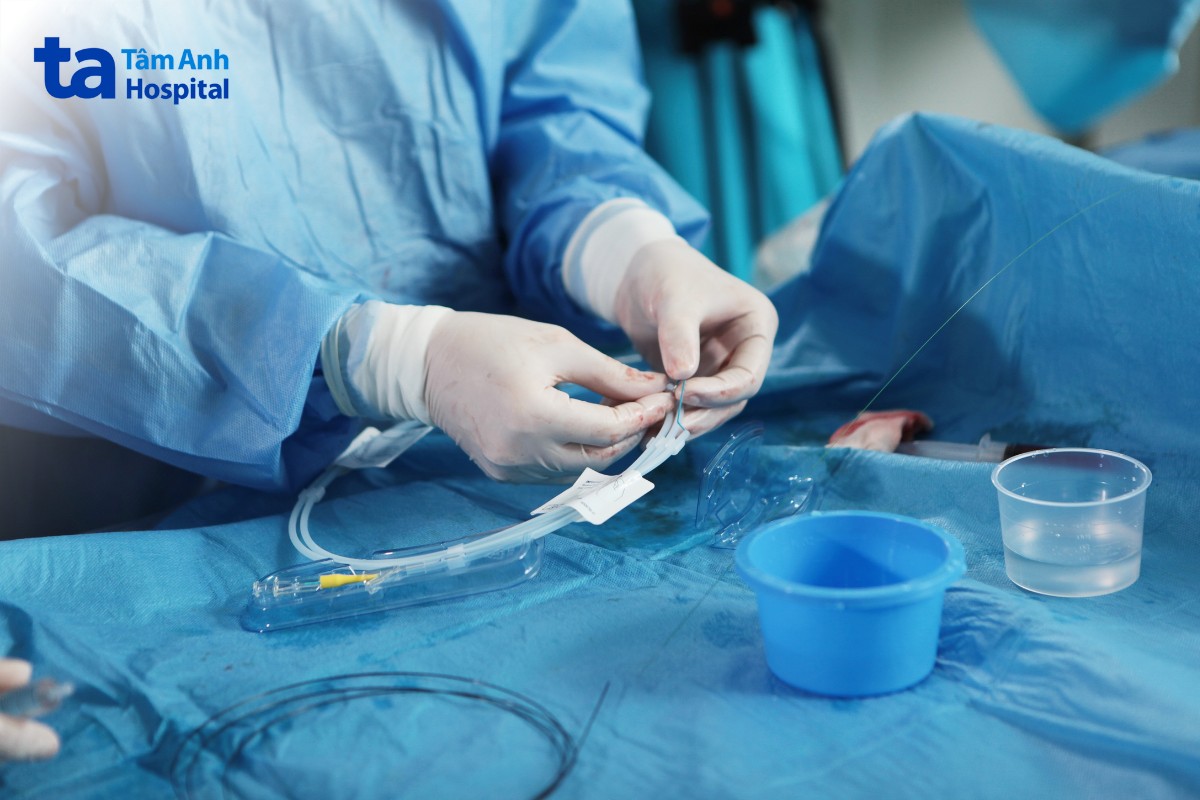 phẫu thuật phình động mạch mạc treo