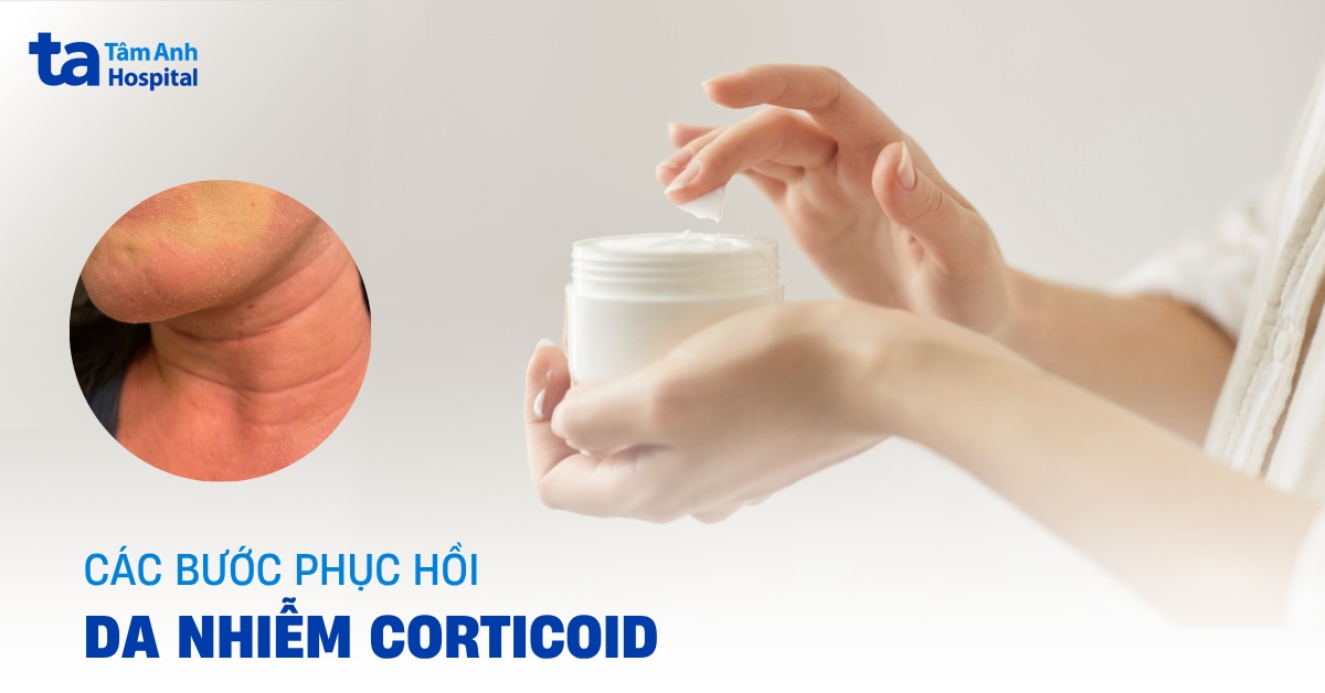 Các bước phục hồi da nhiễm corticoid cần lưu ý gì?