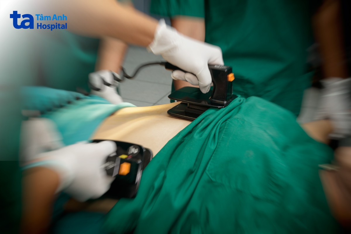 rối loạn nhịp gây suy tim
