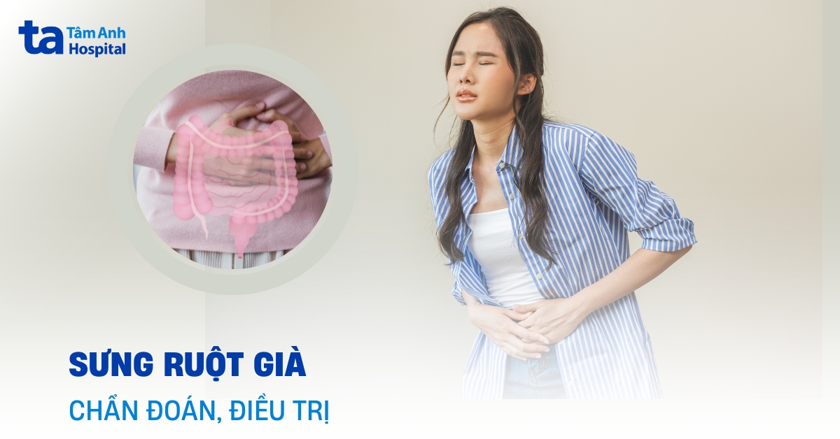 Triệu chứng sưng ruột già dễ bị bỏ qua bạn cần biết