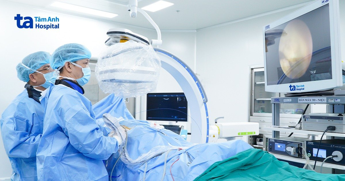 Tán sạch sỏi san hô qua da, không cần truyền máu