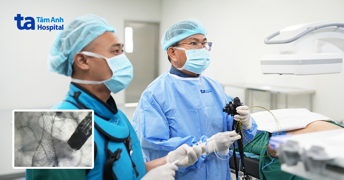 Táo bón kéo dài phát hiện ung thư đại tràng di căn gan