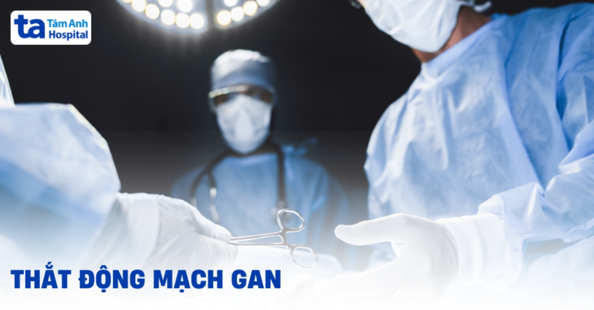 Ứng dụng thắt động mạch gan trong phẫu thuật