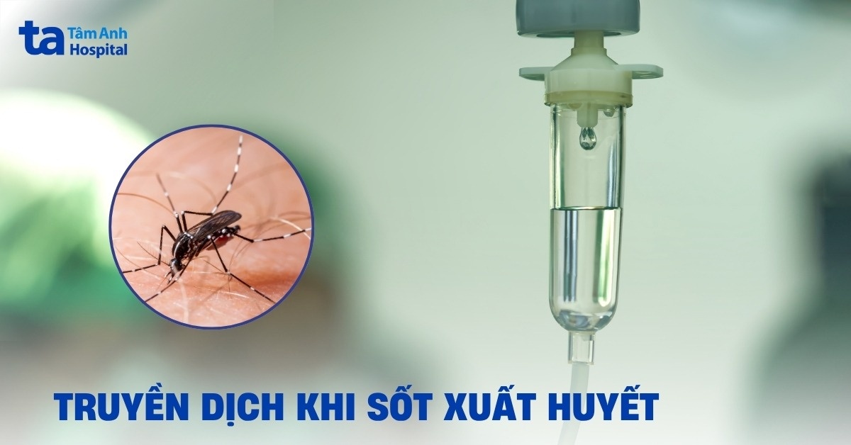 Truyền Dịch Trong Sốt Xuất Huyết