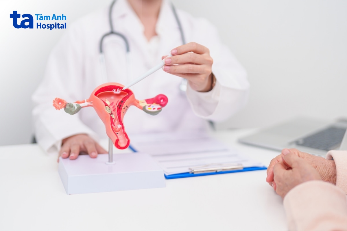 Bác sĩ tư vấn nguy cơ HPV 51 đối với cổ tử cung