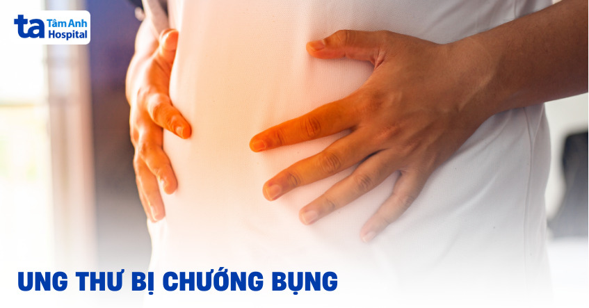 Vì sao ung thư bị chướng bụng?