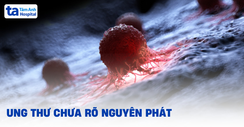 Ung thư chưa rõ nguyên phát: Hướng tiếp cận thế nào?