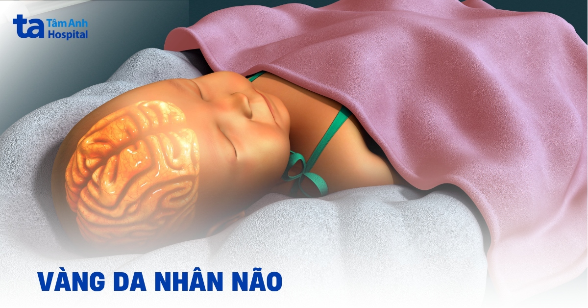 Vàng da nhân não ở trẻ sơ sinh: Cách chăm sóc an toàn