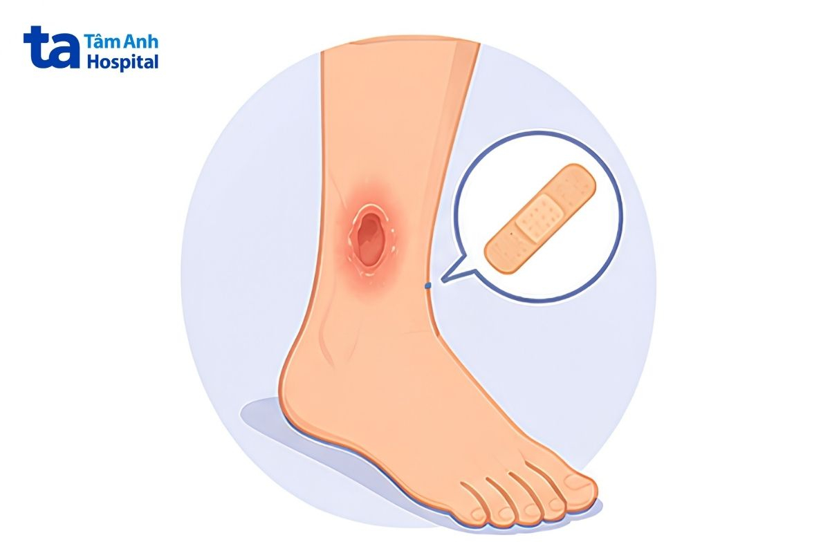 vết thương lâu lành và làm tăng nguy cơ nhiễm trùng