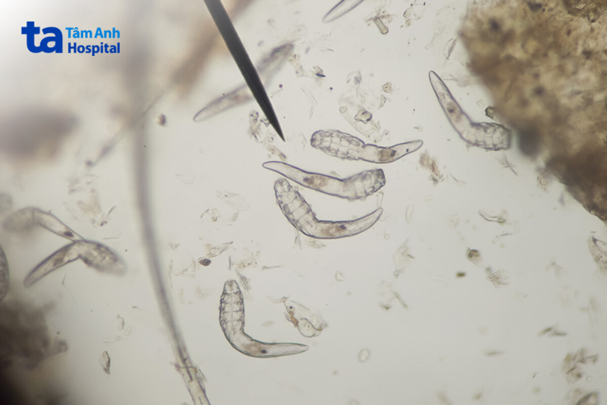 vì sao nhiều người lo lắng ghẻ demodex ở chó có thể lây sang người
