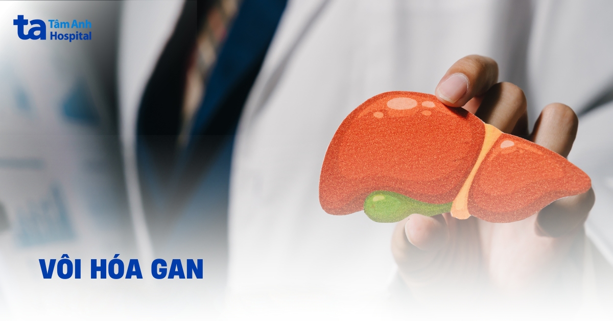 Vôi hóa gan được hình thành như thế nào?