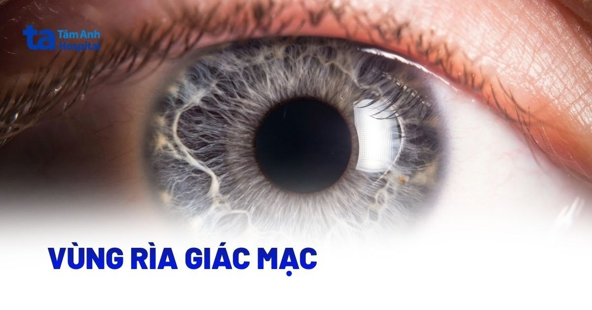 Giải phẫu vùng rìa giác mạc: Cấu tạo, chức năng và bệnh lý