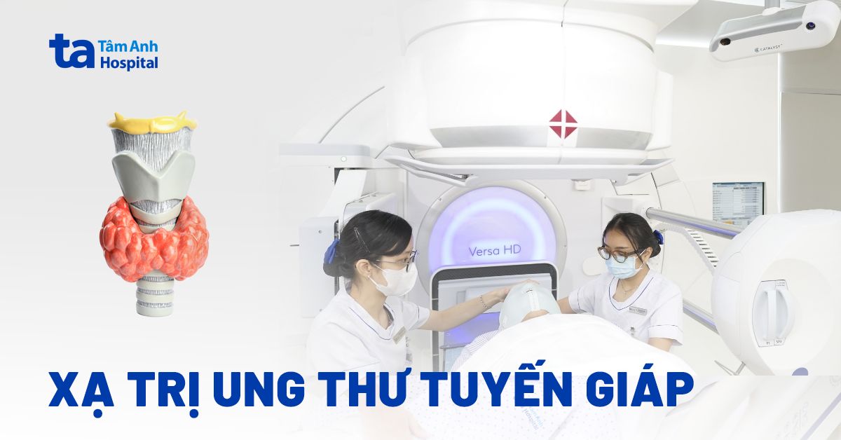 Khi nào cần phải xạ trị ung thư tuyến giáp?
